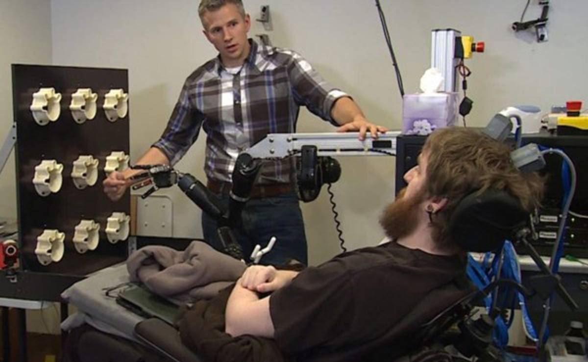 Recupera el tacto gracias a un implante cerebral y un brazo robótico