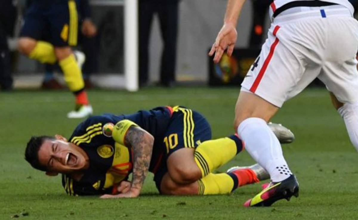 James Rodríguez será baja ante Paraguay tras su luxación en el hombro