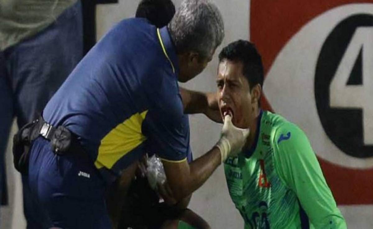 Arquero del Alianza de El Salvador perdió dos dientes en la cancha