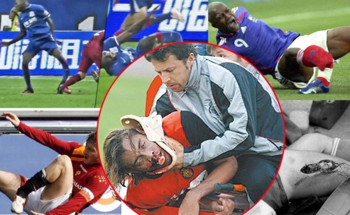 Estas son las lesiones más terribles en la historia del fútbol