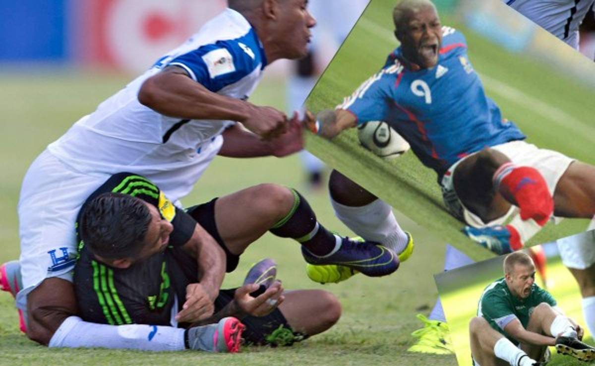 Estas son las lesiones más escalofriantes del deporte en la historia