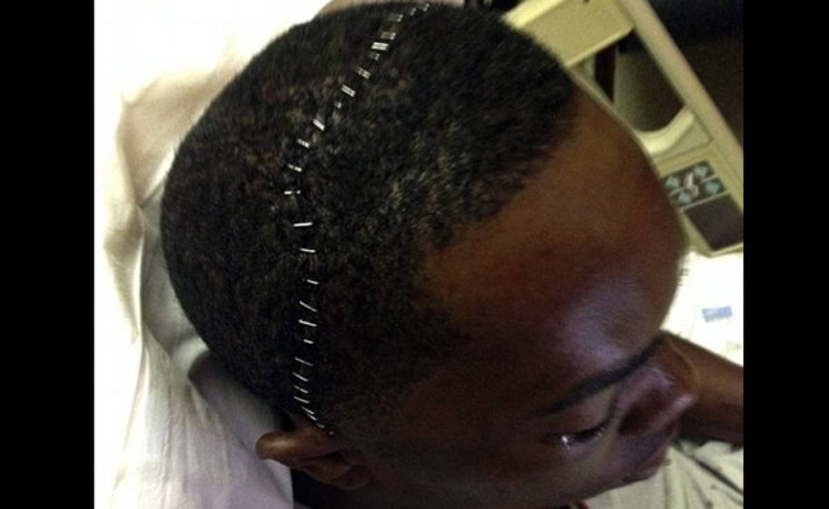 Pitcher Aroldis Chapman se recupera tras operación de cráneo