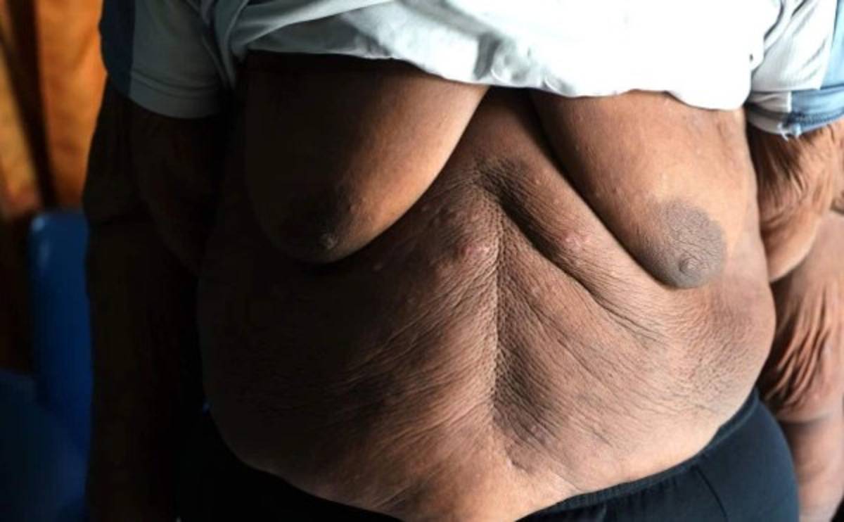 Impresionante: El tremendo cambio físico del niño más obeso del mundo que desea ser futbolista  