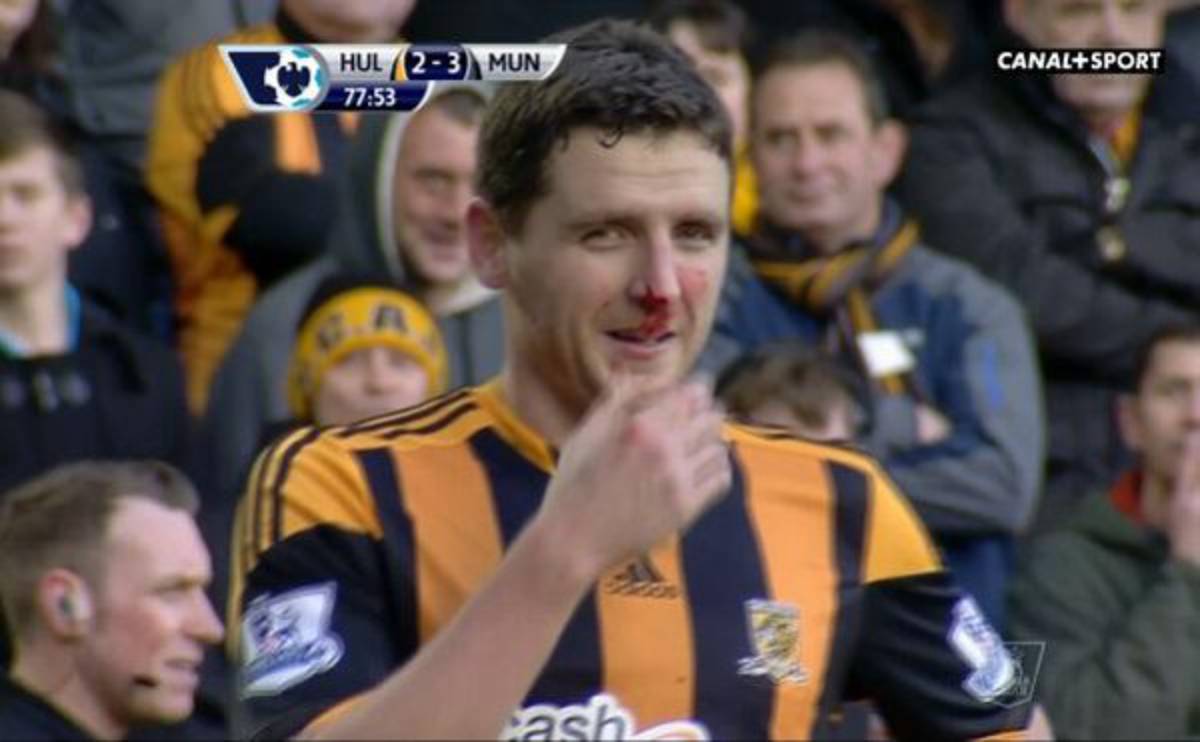 VIDEO: Hijo del técnico de Hull City chocó contra portería y sufre duro golpe en la nariz