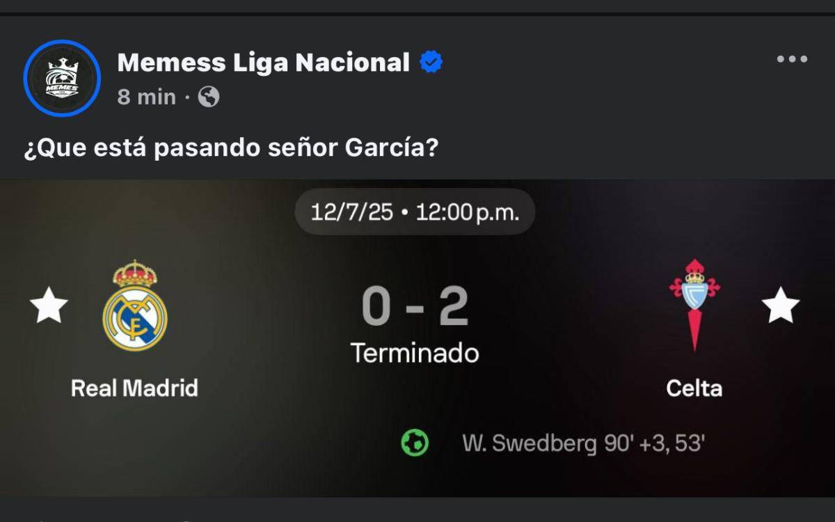 Se burlan de Xabi Alonso: los mejores memes que dejó la derrota del Real Madrid ante el Celta de Vigo por LaLiga