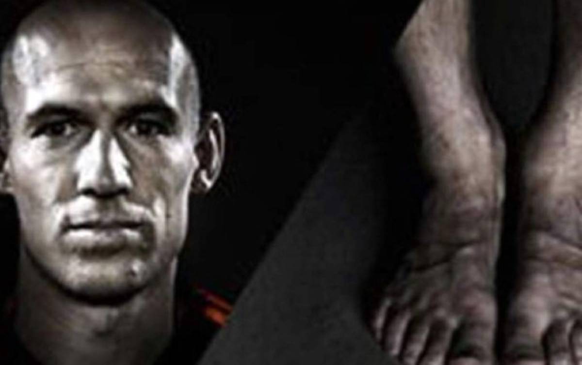 ¡HORRIBLES! Así son los pies más feos de los deportistas famosos