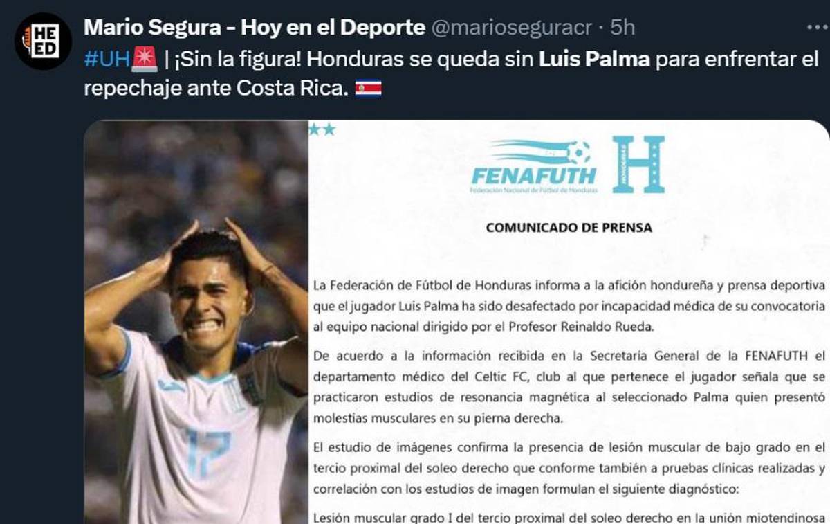 ”Si no se logra pasar ante Honduras, Gustavo Alfaro debe renunciar”, Prensa Costarricense mete presión tras las bajas de La H