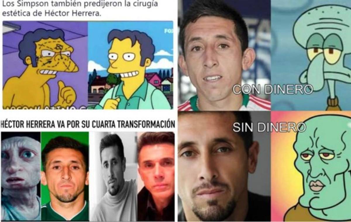 ¡Héctor Herrera es acribillado con memes tras sus cirugías plásticas!