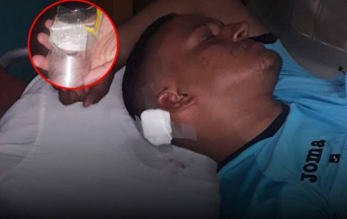 Agresiones, peleas e invasiones: Penosos hechos en la Liga de Ascenso de Honduras