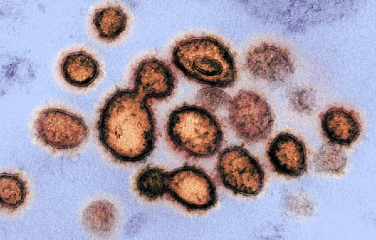 Premio Nobel por descubrir el VIH aseguró que el coronavirus fue creado en un laboratorio