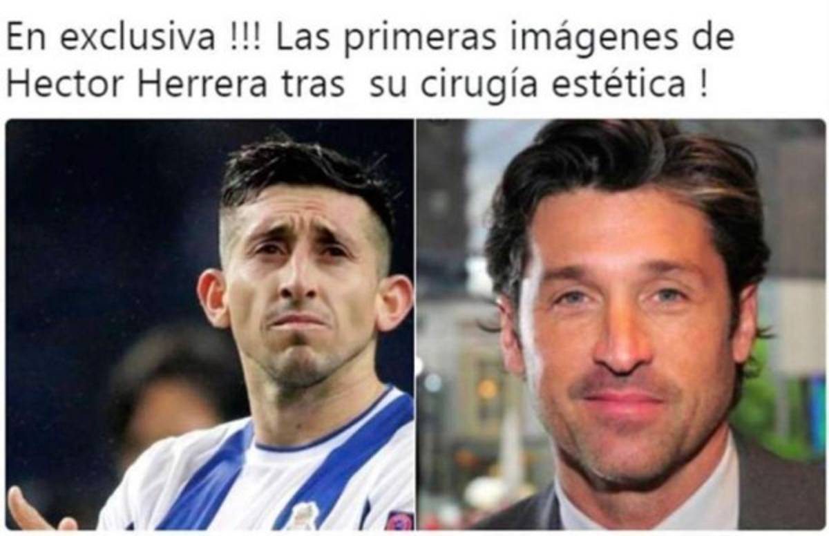 ¡Héctor Herrera es acribillado con memes tras sus cirugías plásticas!
