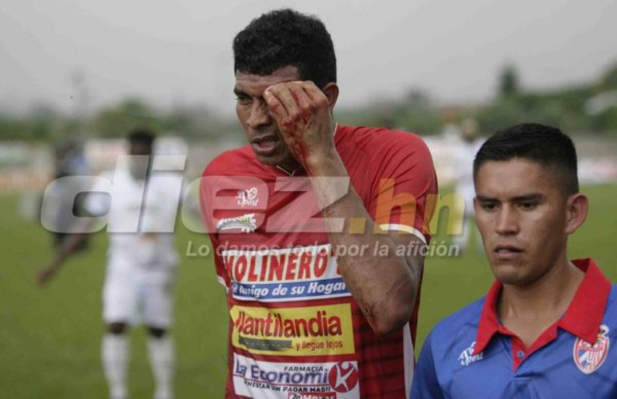 Sangre, abejas, chicas lindas y besos en las fotos curiosas de la fecha 7&nbsp;&nbsp;