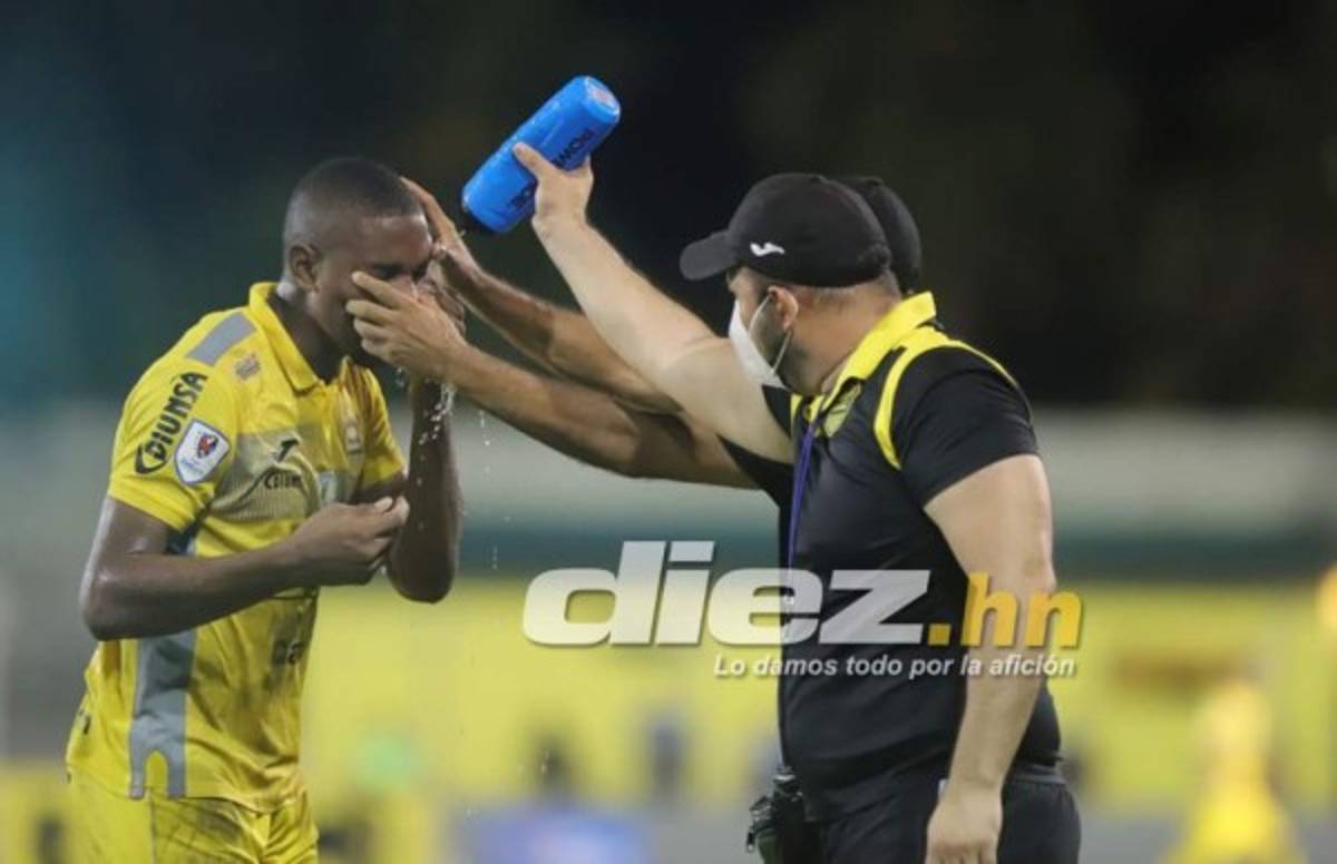 Lo que no viste en TV en la jornada 9: bellezas, beso apasionado de Pereira ¡y graves heridas a dos jugadores!