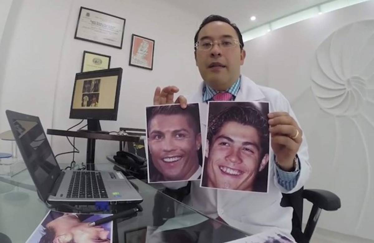 Cristiano Ronaldo: Desvelan las cinco cirugías que se realizó para cambiar su imagen