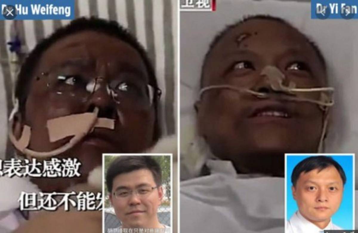 El terrible cambio de piel de dos médicos chinos sobrevivientes del coronavirus en Wuhan