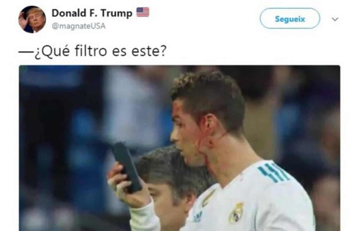 ¡VIRAL! Los memes de Cristiano Ronaldo por mirar su herida en el celular