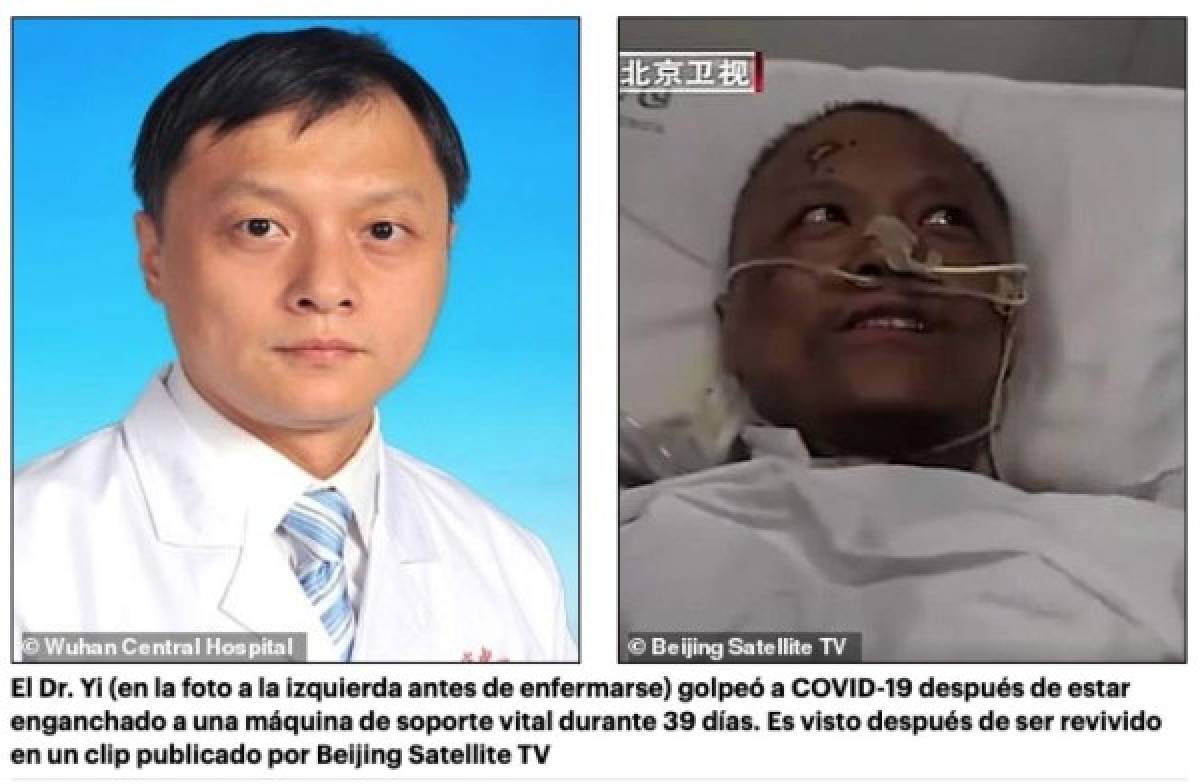 El terrible cambio de piel de dos médicos chinos sobrevivientes del coronavirus en Wuhan