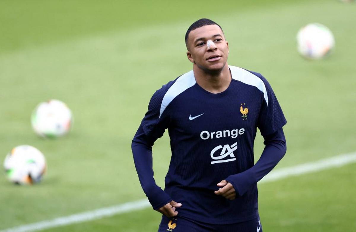 Las primeras fotos de Kylian Mbappé tras fracturarse la nariz en la Eurocopa 2024: el anuncio de su entrenador