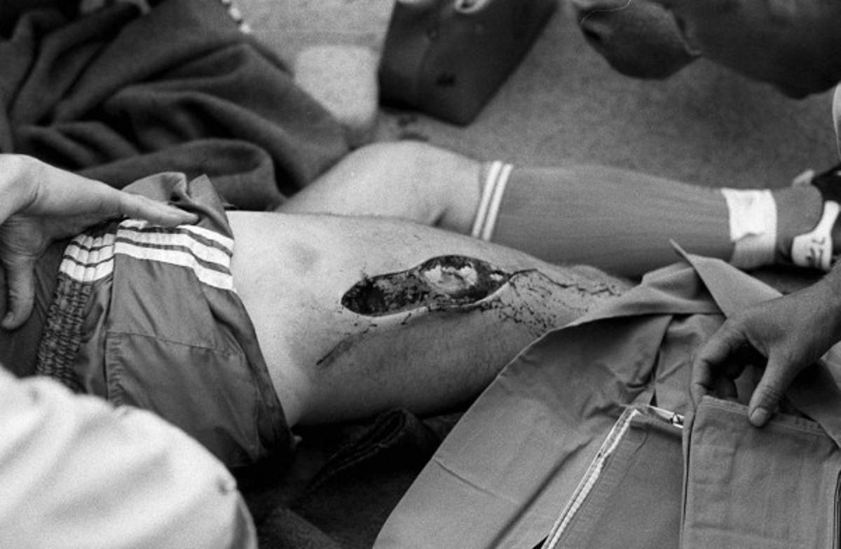 Estas son las lesiones más terribles en la historia del fútbol