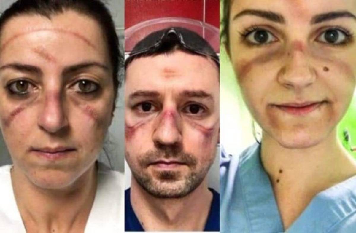 Coronavirus: Las enfermeras que se suicidaron en Italia por culpa de la pandemia