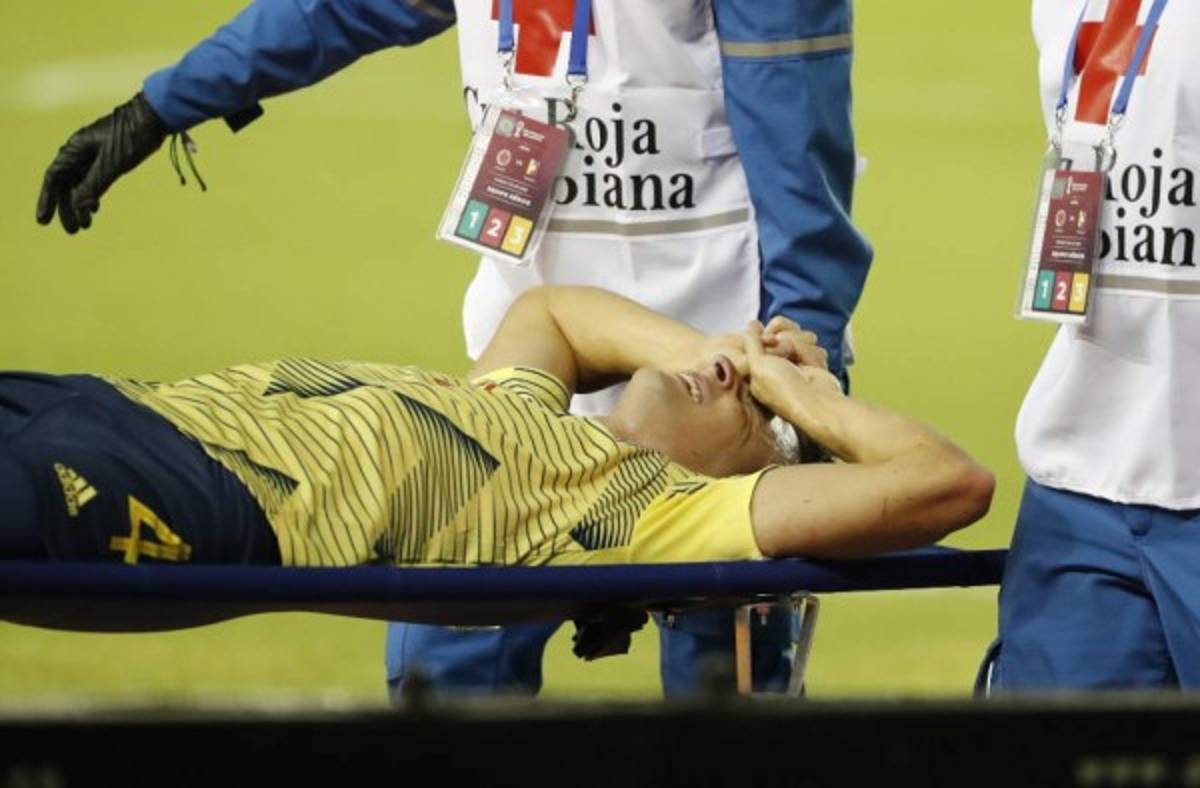 Dolorosas imágenes: así quedó el tobillo de Santiago Arias tras sufrir terrible lesión en el Colombia-Venezuela