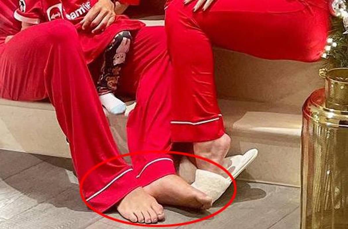 ¡Al descubierto! Así son los pies más feos de algunos deportistas reconocidos a nivel mundial; los de CR7 y Lebron son horribles