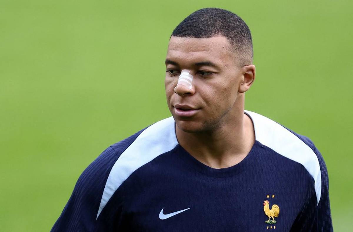 Las primeras fotos de Kylian Mbappé tras fracturarse la nariz en la Eurocopa 2024: el anuncio de su entrenador