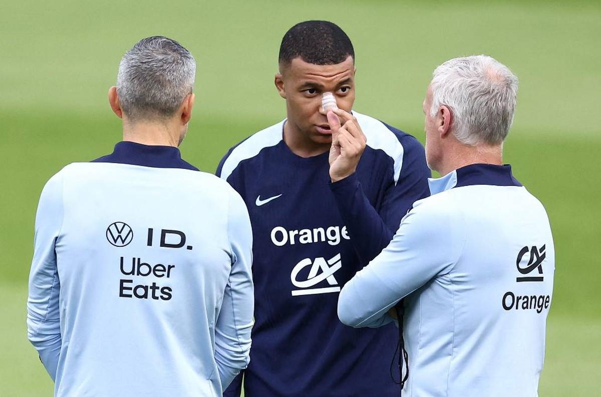 Las primeras fotos de Kylian Mbappé tras fracturarse la nariz en la Eurocopa 2024: el anuncio de su entrenador