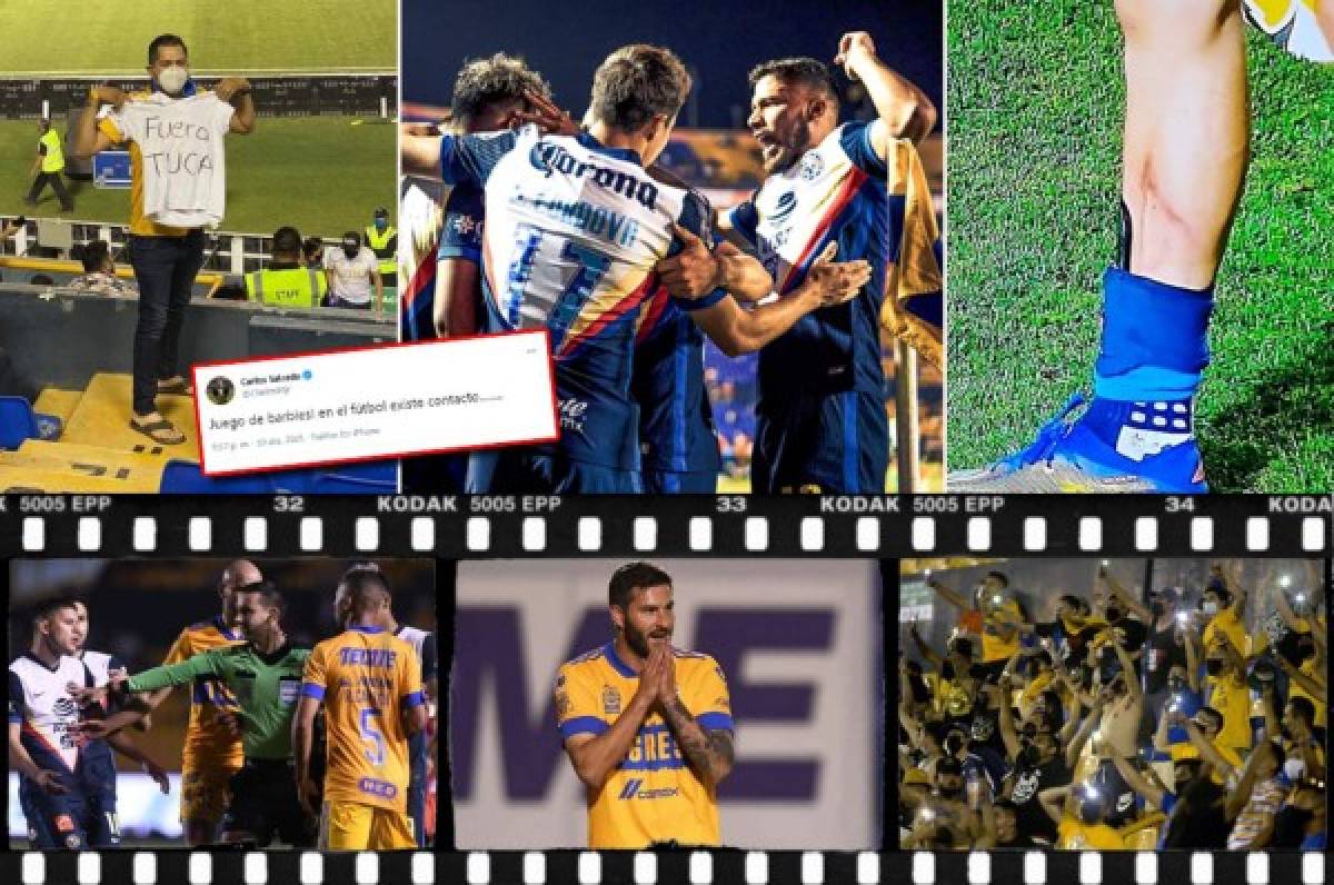 ''Juego de Barbies'': figura de Tigres explota y así quedó la pierna de jugador del América en la Liga MX