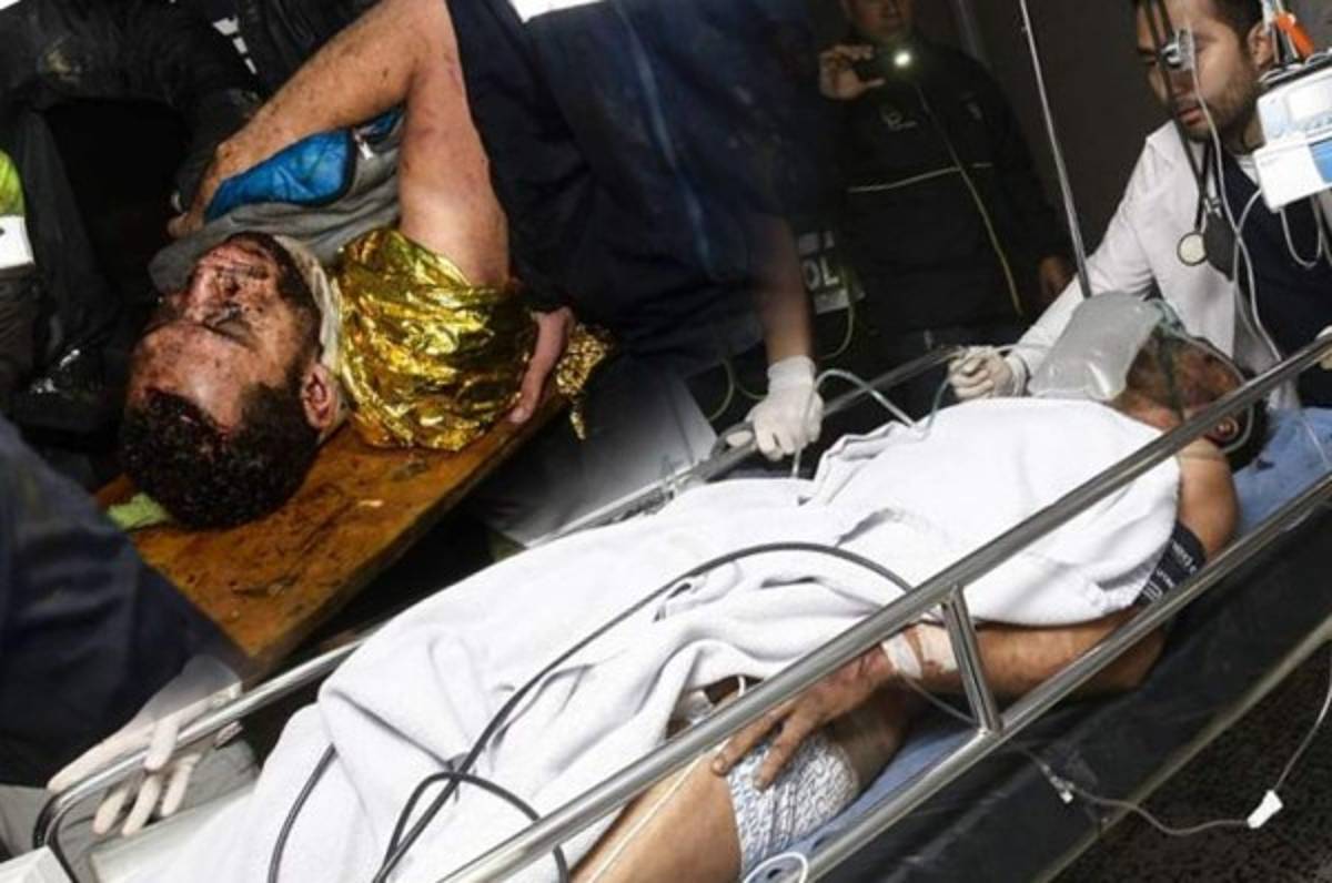 ¡Terribles noticias para dos sobrevivientes de la tragedia del Chapecoense!