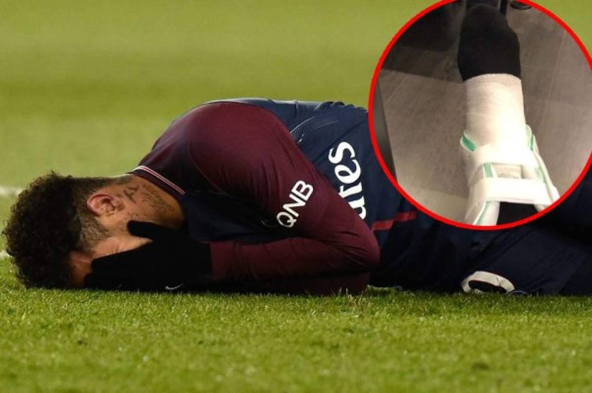 Así está el tobillo de Neymar previo al choque europeo contra el Real Madrid