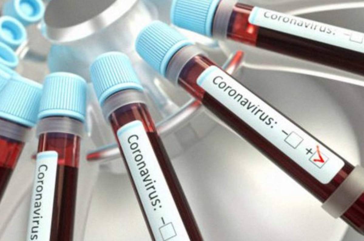 Revelan el medicamento que por primera vez ha tenido un ''claro efecto'' contra el coronavirus