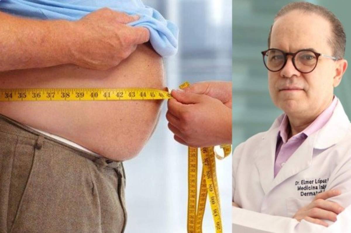 El blog de Elmer López: '¿Por qué es tan difícil bajar de peso? La mejor estrategia para lograrlo'