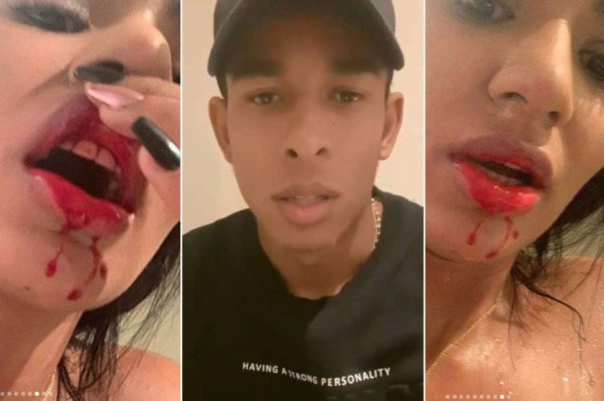 La respuesta de Sebastián Villa tras la denuncia y las fotos que publicó su novia agredida