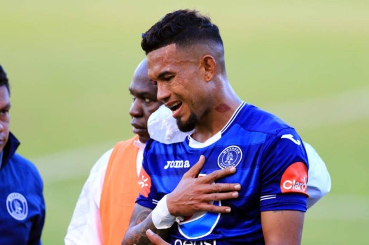 Carlos Discua es operado con éxito y estará 5 semanas de baja