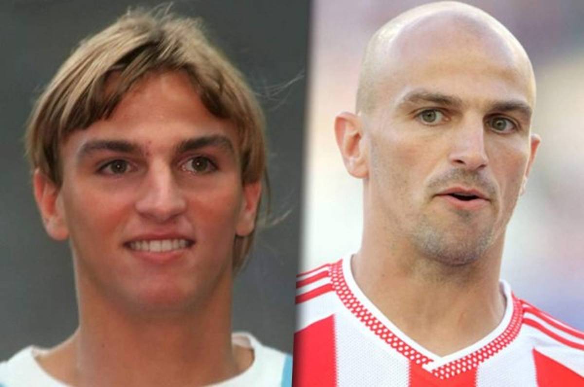 TOP 15: Los futbolistas que han quedado calvos a lo largo de su carrera