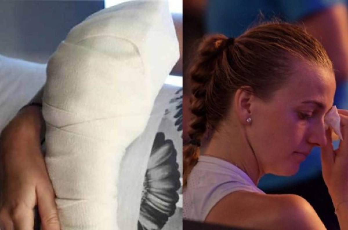 Escalofriante relato de Kvitova: 'Se cortaron todos los dedos de mi mano izquierda'