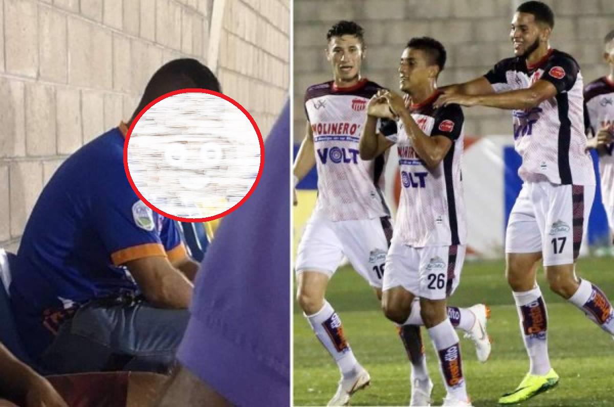 Lo bañaron de aceite quemado y fueron agredidos: varios hondureños también sufrieron racismo en Guatemala, Polonia, Italia y Austria