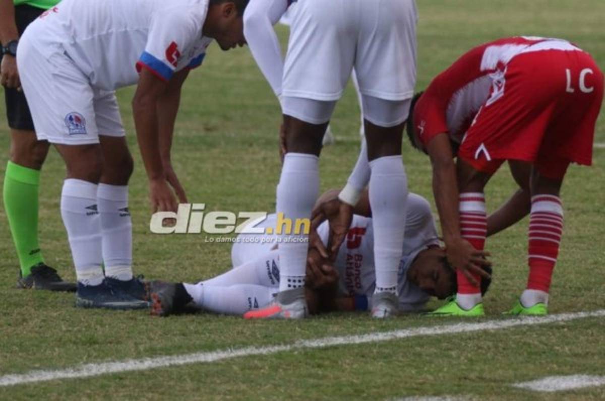 Doctor Óscar Benítez confirma que Carlos Pineda es baja por seis meses y será operado