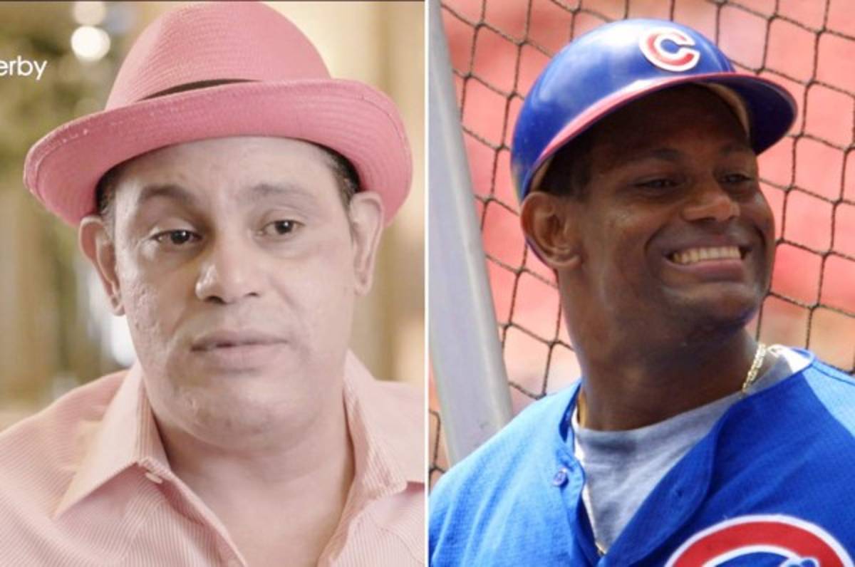 Polémica por el aclaramiento de piel del exbeisbolista Sammy Sosa