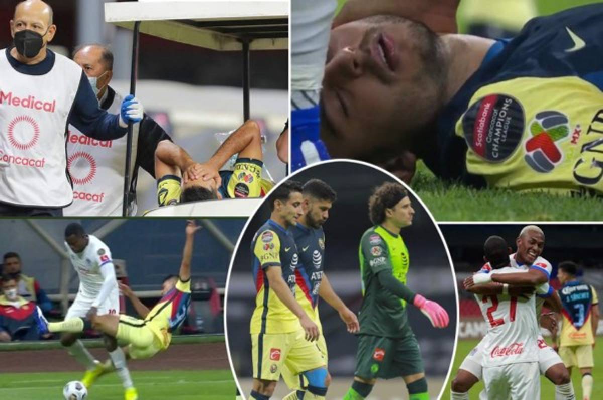 En fotos: 'Memo' Ochoa explotó contra Arboleda; Nicolás Benedetti dio el gran susto