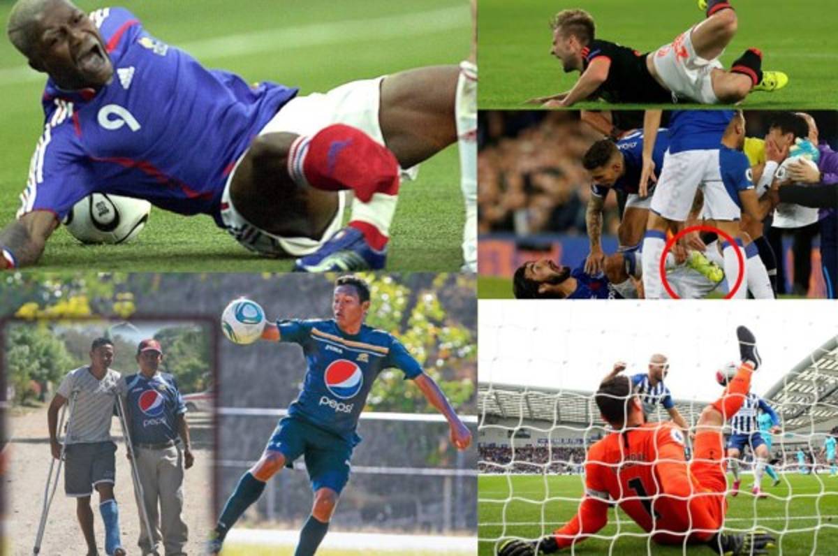 Las lesiones más escalofriantes que se han dado en el fútbol, André Gomes el último  