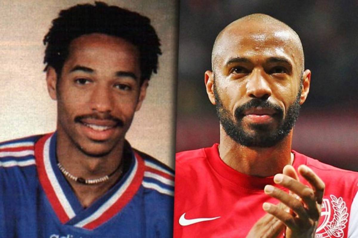 TOP 15: Los futbolistas que han quedado calvos a lo largo de su carrera