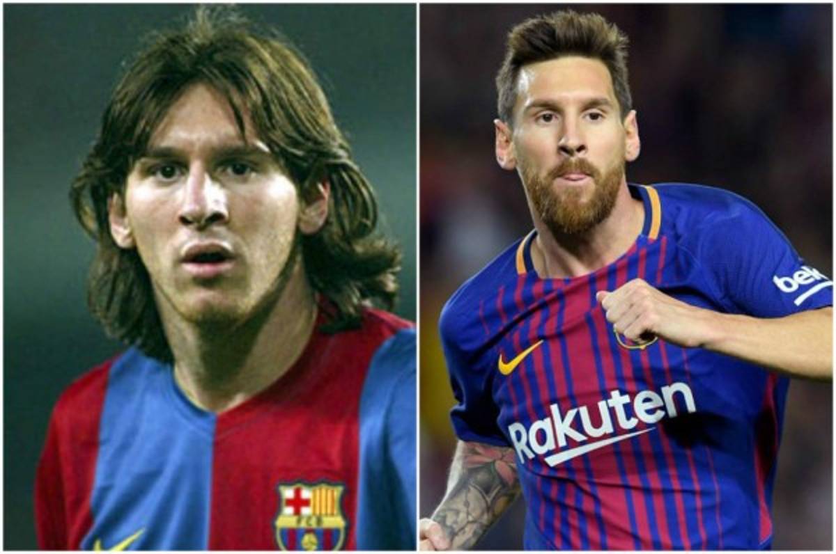 ¡NO ERAN ASÍ! Las figuras que tuvieron que pasar por una cirugía para mejorar su apariencia