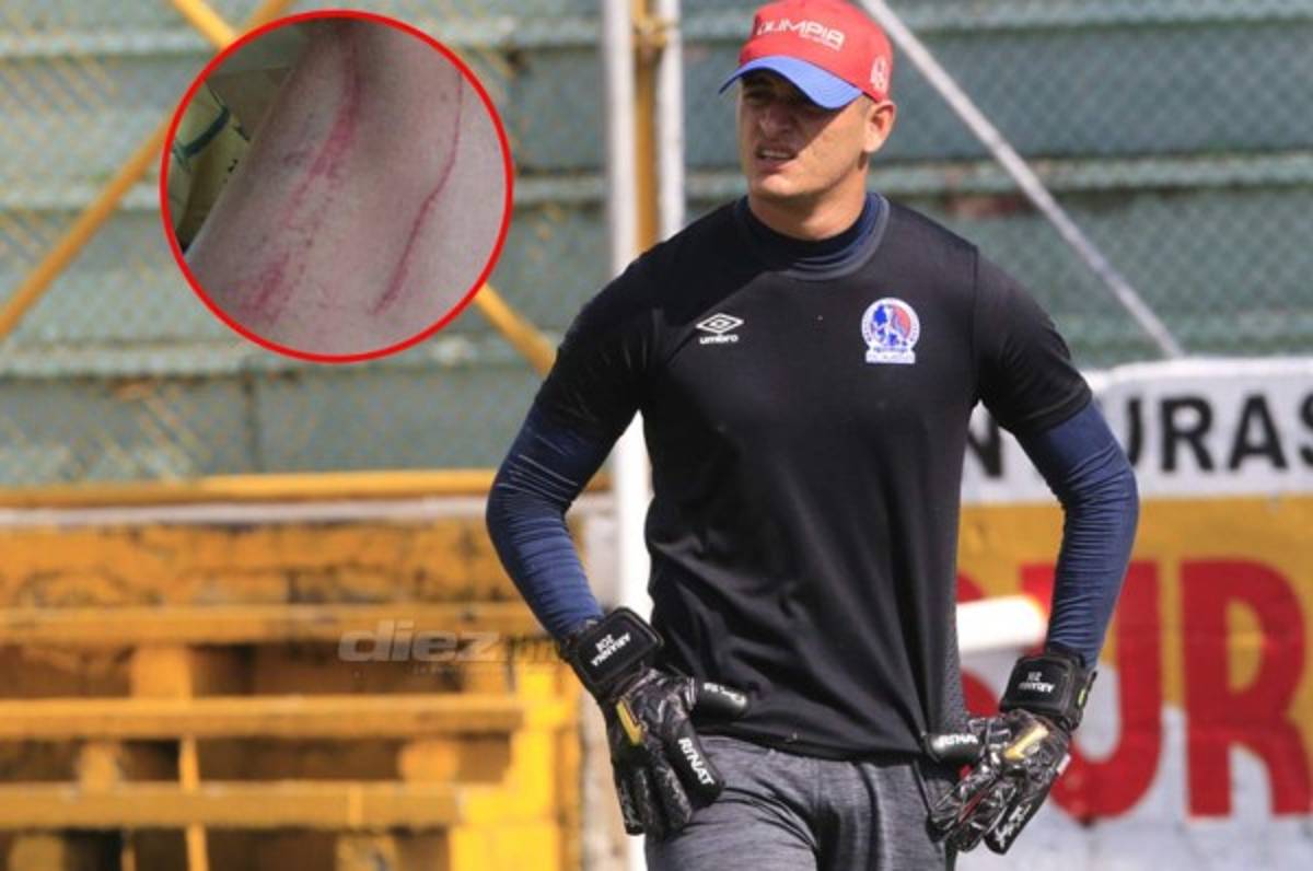 Olimpia pierde a Harold Fonseca para el clásico ante Motagua en el Olímpico