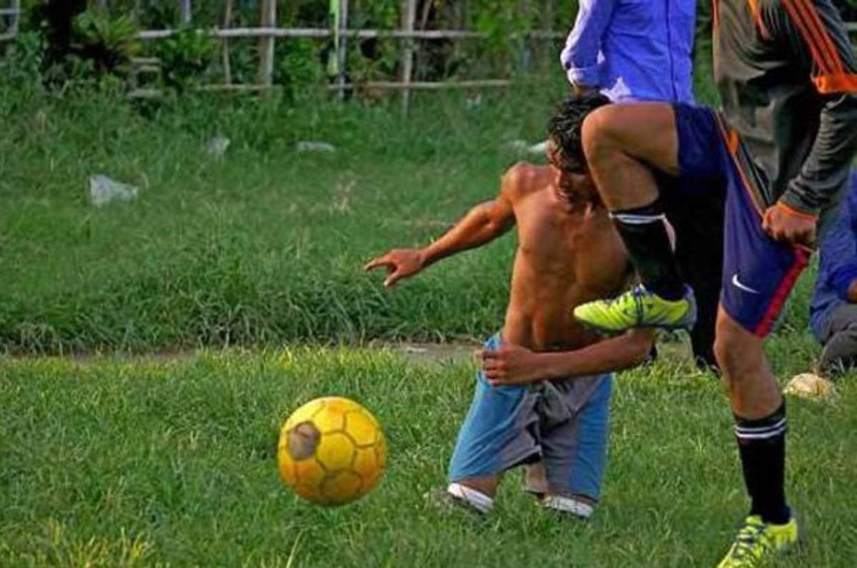 ADMIRABLE: No tiene sus dos piernas pero sueña con ser un futbolista profesional