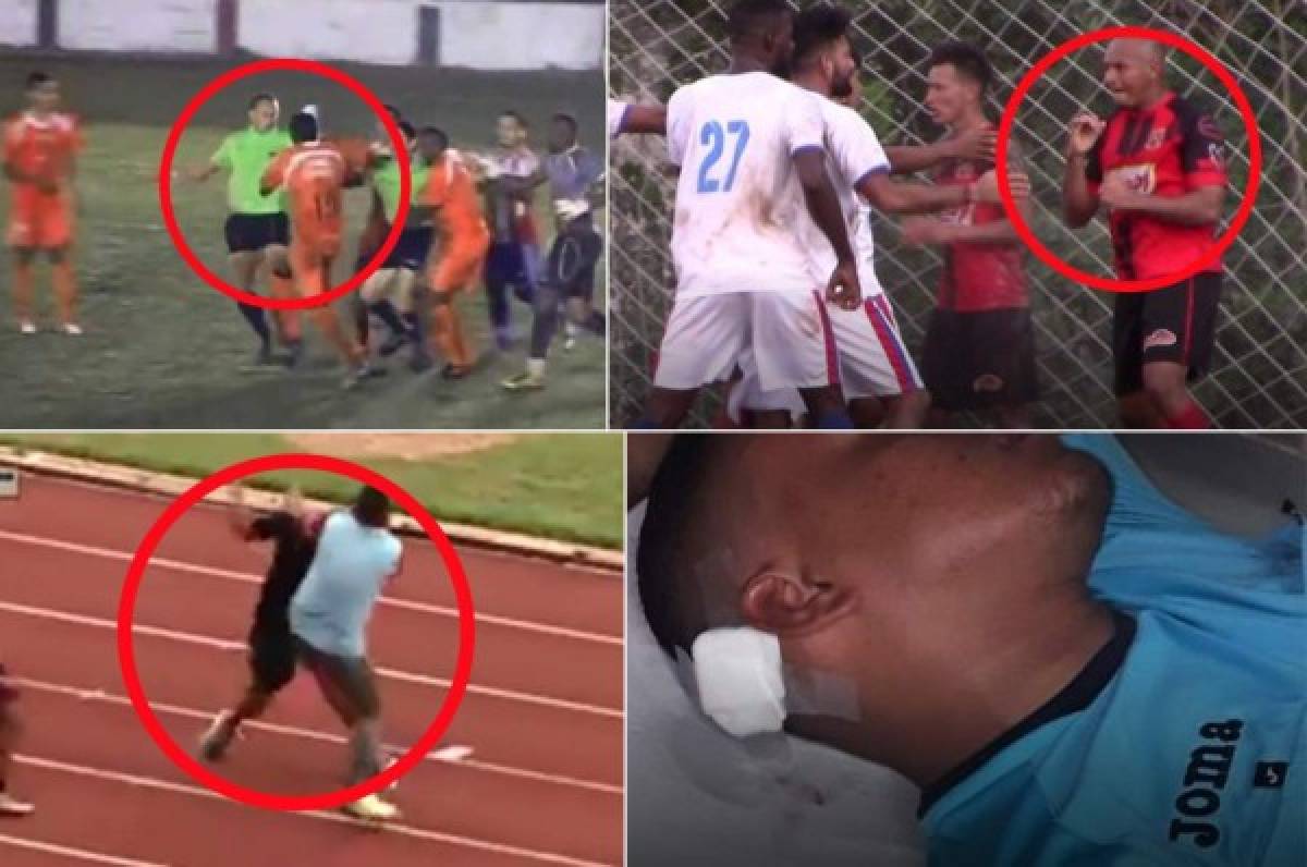 Agresiones, peleas e invasiones: Penosos hechos en la Liga de Ascenso de Honduras