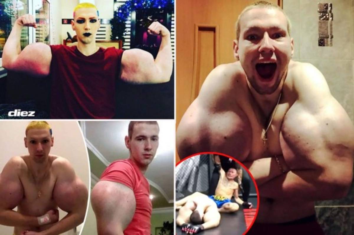 Así es el ''Popeye'' ruso, el luchador que fue humillado durante su debut en la MMA