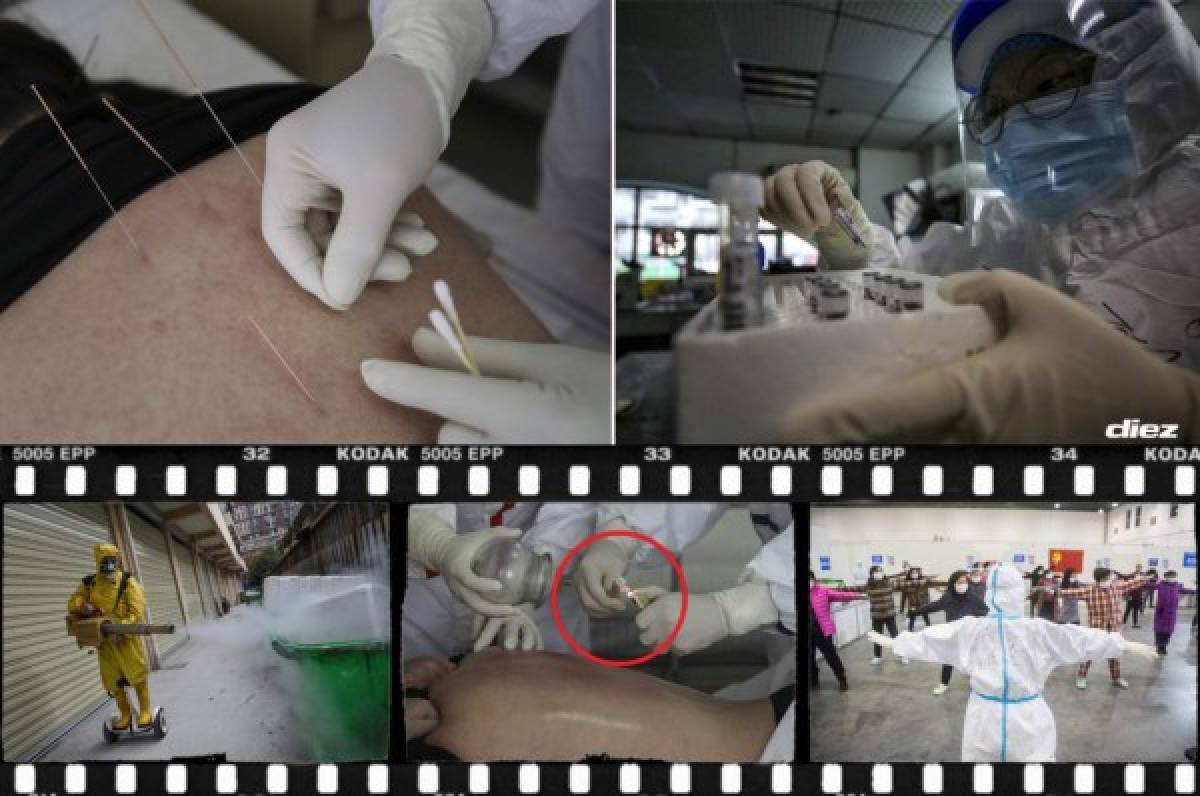 Las técnicas ancestrales que utilizan los médicos chinos para eliminar el coronavirus