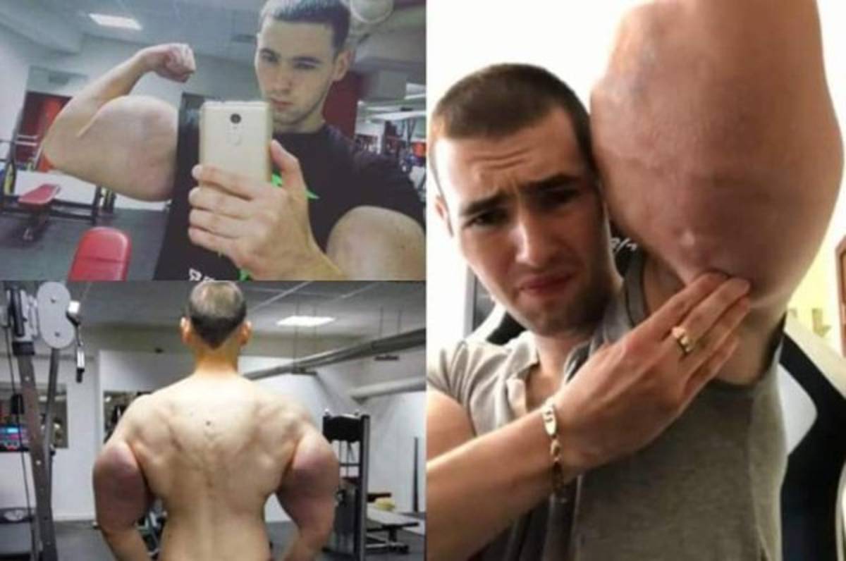 La terrible pesadilla que vivió el 'Popeye' ruso: ''Estaba tirado sintiendo que me moría''